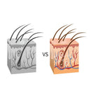 Rádio Frequência e Luz LED